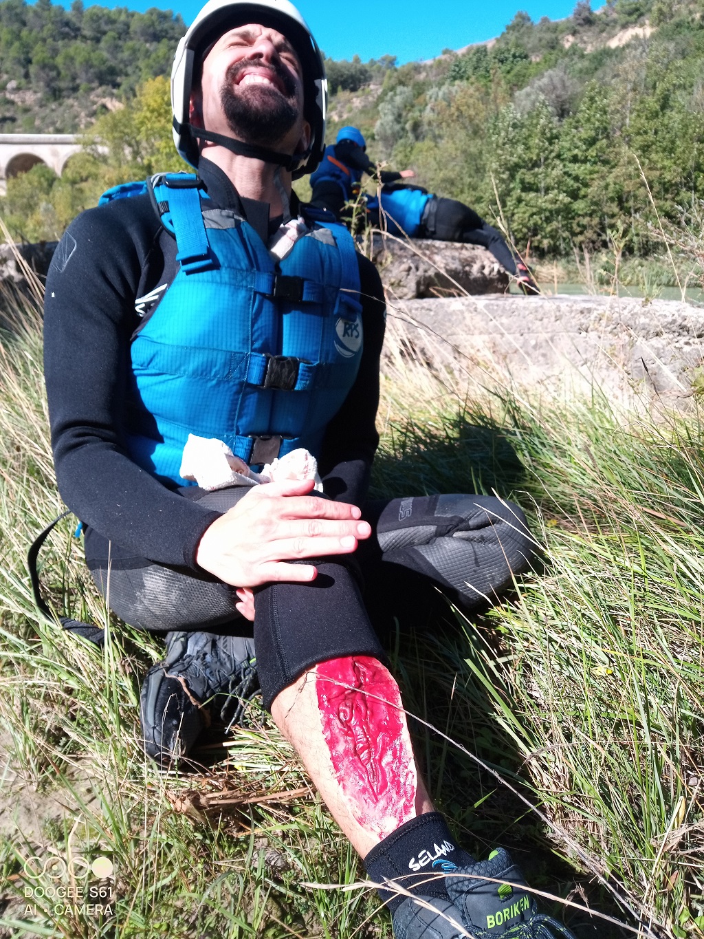 Simulación de herida abierta en la pierna de un accidentado en el medio natural para formación de guías.
